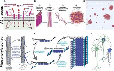 The Rhesus Macaque as a Translational Model for Neurodegeneration and Alzheimer’s Disease